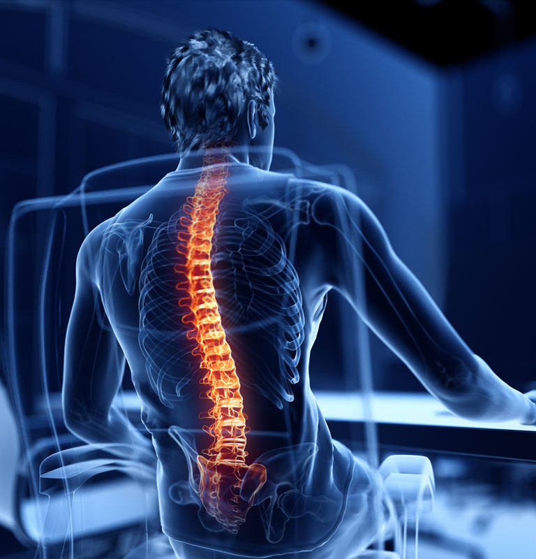 back-pain